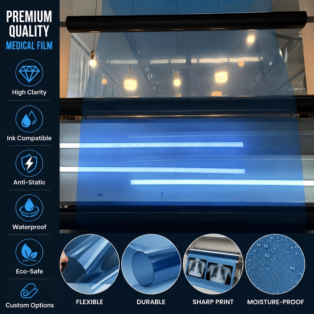 Medical Inkjet Blue Film ;Waterproof for X-ray CT MR Film