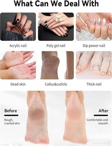Set de Manicura y Pedicura de Alta Potencia, Lima para Pies Inalámbrica Recargable, Removedor de Callos - Product Image 5