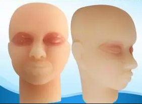 แบบฝึกหัดเย็บผิวหนังสำหรับการฝึกผ่าตัดศัลยกรรมตกแต่งความงาม ใช้สำหรับการฝึกเย็บตาสองชั้นด้วยวัสดุซิลิโคน PVC ทางการแพทย์ - Product Image 6