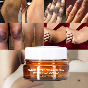 SERSANLOVE para eliminar espinillas y brillo de la piel, corrector de manchas oscuras, crema facial blanqueadora, corrección en chino 20G - Product Image 1