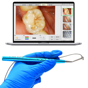 Microscopio Dental con Pieza de Mano, Imágenes de Alta Definición, Observación en Miniatura, Endoscopio WIFI, Interfaz USB Conectable para - Product Image 2