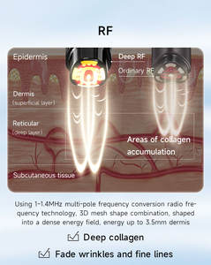 מכשיר יופי נייד בטכנולוגיית RF להצערת עור הפנים, הרמה, הפחתת קמטים וטיפול יומיומי - Product Image 5