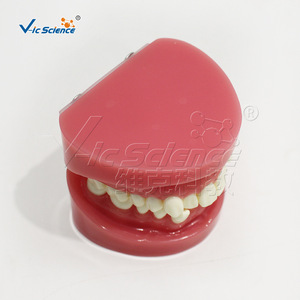 Modèle d'alignement dentaire défaillant, modèle dentaire, modèle pédagogique pour la pratique orale dentaire - Product Image 3