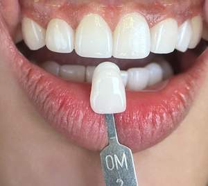 قرص سيراميك متعدد الطبقات UT-ML فائق الشفافية من Ivista بقوة 650 ميجا باسكال، أفضل كتلة زركونيا لمختبرات الأسنان - Product Image 5