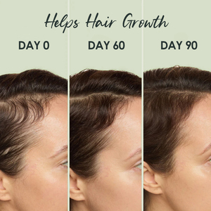 Après-shampoing Capillaire Naturel à la Biotine, Caféine et Kératine pour la Croissance, la Réparation et la Nutrition des Cheveux, Anti-Frisottis, Marque Blanche - Product Image 5