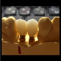 Bloc zircunia ht plus pour implant dentaire