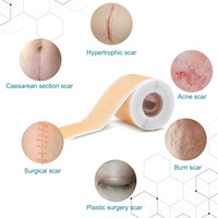 Bande adhésive en silicone réutilisable de 1,5 m, souple et respirante, pour cicatrices anciennes et nouvelles, réparation cutanée des cicatrices hypertrophiques et chéloïdes