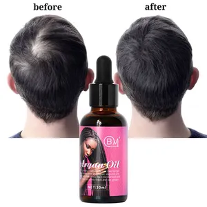 Aceite de suero para el crecimiento del cabello para hombres y mujeres, aceite de suero para el crecimiento del cabello vegana, marca privada, superventas