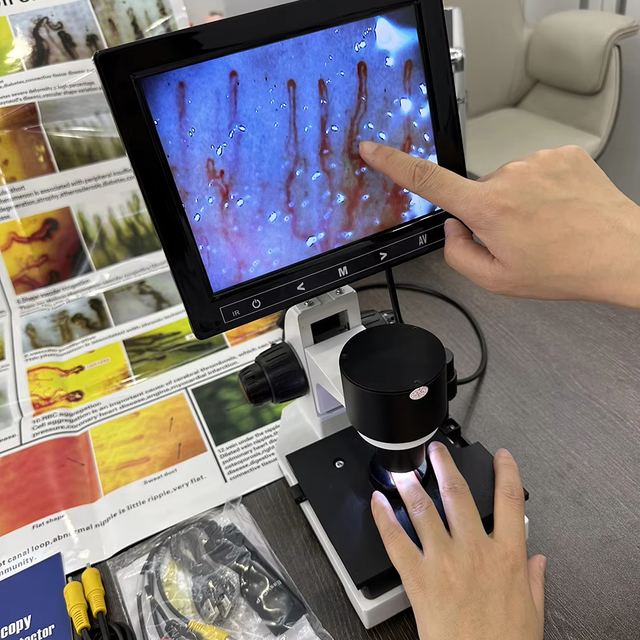 Biological Nail Fold Blood Test Digital Microcirculation Microscope Digital Capillary Microscope