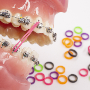 Autres équipements dentaires Bandes <span class=keywords><strong>molaires</strong></span> élastiques colorées haute performance Matériaux élastiques orthodontiques - Product Image 4