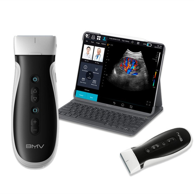 128 Elements Wifi Ultrasound USG/Wireless Ultrasound IOS Android Mobile Device Color Doppler Ultrasound Convex/Linear Probe