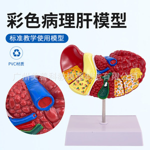 Modèle d'anatomie hépatique humaine pour simulation médicale, hilaire hépatique, vésicule biliaire, structure des voies biliaires, organe du système digestif - Product Image 3