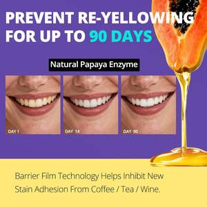 Bandes blanchissantes pour dents <span class=keywords><strong>5D</strong></span> certifiées 2026, marque privée, blanchiment dentaire à domicile, bandes blanchissantes violettes, bandes blanchissantes dentaires organiques - Product Image 3