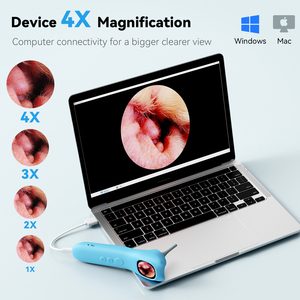 Q12-B caméras d'oreille d'animaux Observation en temps réel jusqu'à 128 Go Ensemble visuel Caméra d'oreille Vidéos photo Otoscope HD avec étui en silicone - Product Image 6