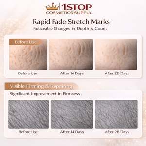 Vergetures, hydrate pour aider à prévenir les vergetures, a montré une amélioration notable en 4 semaines, professionnel - Product Image 2