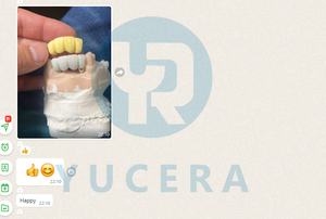 Impresora 3D Dental de Escritorio Yucera DJ89 Plus - Revoluciona el Laboratorio Dental con una Resolución Nítida de 4K - Product Image 6