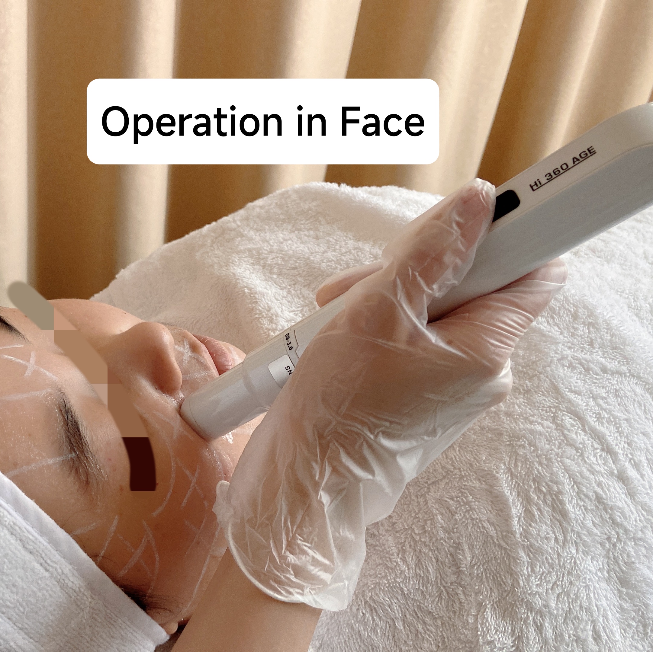 2023 New 8D HIFU Ultrasound Skin Tightening Machine Hifu Therapy For Face And Neck Lifting