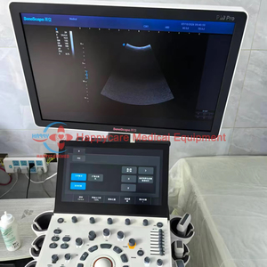 Échographe Sonoscape P10 Pro pour gynécologie et cardiologie, système d'imagerie fœtale HD, échographe d'occasion - Product Image 1