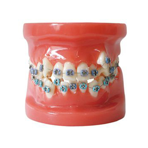 Vente en gros et au détail d'ensembles complets en acrylique modèle de dents dentaires étui orthodontique - Product Image 3