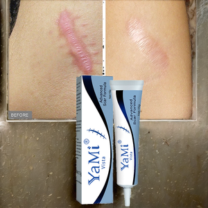 Crema para Eliminar Cicatrices Fuerte y Efectiva de Marca Privada para Cicatrices Antiguas en las Piernas, Gel para Marcas de Acné, Quemaduras y Estrías para Piel Dañada - Product Image 2