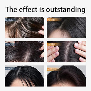 Fábrica Venda Quente Shampoo Bulk Organic Natural Shampoo Personalizado OEM Contendo Argan/Azeite/Erva/Aloe Vera/Queratina - Product Image 6