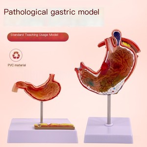 Modelo <span class=keywords><strong>de</strong></span> anatomía educativa <span class=keywords><strong>de</strong></span> Gastroenterología, sección coronal ampliada <span class=keywords><strong>de</strong></span> PVC, perforación patológica del estómago para la ciencia médica - Product Image 6