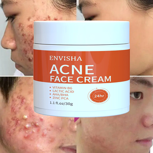OEM ODM rápido eficaz cuidados com a pele iluminando marcas hidratantes psiquiatra poros melhorar cravo poros espinhas gel creme facial - Product Image 1