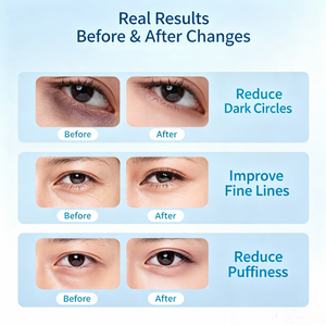 Patchs rafraîchissants pour les yeux de qualité supérieure et au meilleur prix, pour les yeux gonflés et les cernes, avec collagène hydrolysé, cadeaux pour demoiselles d'honneur pour femme - Product Image 2