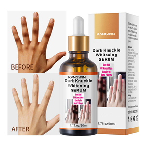 Veganes Schnell-Aufhellungs-Serum für Gesicht, dunkle Knöchel, Hände, Ellbogen, Knie, Fleckenentferner, Pigmentkorrektur-Serum für dunkle Haut - Product Image 6