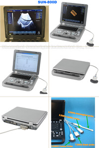 Cuaderno médico portátil con pantalla de 15 pulgadas, instrumento de ultrasonido 3D B/W para humanos con sonda OB/GYN/Vascular/Urología - Product Image 6