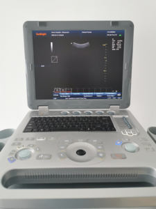 Geavanceerde model humane zwangerschaps-echografie scanner ziekenhuizen 3D 4D kleuren <span class=keywords><strong>Doppler</strong></span> echografie <span class=keywords><strong>scan</strong></span> - Product Image 3