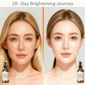 Sérum Visage à la Vitamine C et à l'Aloe Vera en Marque Blanche <span class=keywords><strong>pour</strong></span> Anti-Âge, Blanchiment et Soulagement de l'Acné, Booster Hydratant <span class=keywords><strong>pour</strong></span> les Soins de la Peau - Product Image 2