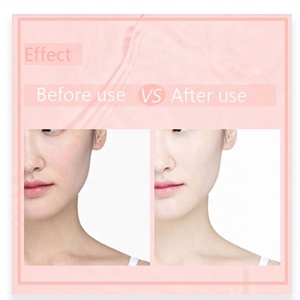 Etiqueta Privada 100% puro y natural Rosa agua niebla cara para el cuidado de la piel - Product Image 6