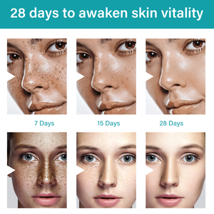 Crème Visage Éclaircissante Anti-Taches et Anti-Mélasma à Marque Blanche, <span class=keywords><strong>Efficace</strong></span> et Puissante pour l'Élimination des Taches de Rousseur et de Mélanine - Product Image 4