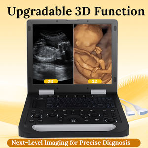 Ecografo Portatile 3D Digitale a Colori Doppler con Sonda Convessa Integrata da 3.5MHz per Uso Umano e Veterinario (Gravidanza Animale) - Product Image 4