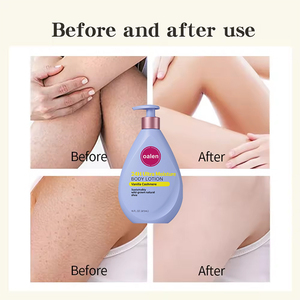 Lotion corporelle <span class=keywords><strong>hydratante</strong></span> et apaisante Oalen Private Label Vanille Cachemire, grande taille 473 ml, pour peaux sèches, irritées et squameuses, automne-hiver, effet blanchissant. - Product Image 5