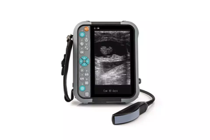 Scanner à ultrasons pour animaux, utilisation vétérinaire, clinique de ferme, taille de paume - Product Image 3