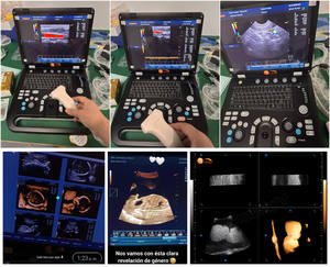 Ecógrafo Portátil de Diagnóstico Médico con Pantalla Grande de 15 Pulgadas, <span class=keywords><strong>Precio</strong></span> <span class=keywords><strong>3D</strong></span> - Product Image 3