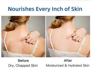 โลชั่นบำรุงผิวกายไฮยาลูรอนิค แอซิด 200 มล. สำหรับผู้หญิง - Product Image 6