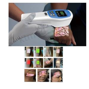 جهاز محمول للكشف عن الأوردة بالأشعة تحت الحمراء للحقن الوريدي، جهاز مراقبة بيطري، محدد مواقع للممرضات والطاقم الطبي - Product Image 5