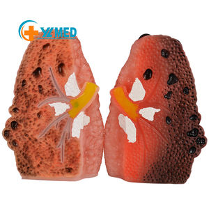 Modèle de poumon fumeur en PVC, taille réelle, comparaison pathologique en coupe transversale, poumon sain vs malade, éducation médicale, santé - Product Image 1