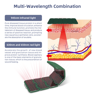 Equipo eléctrico de terapia láser infrarrojo para el alivio del dolor de rodilla, acupuntura, dispositivo médico de Fisioterapia con luz roja - Product Image 4