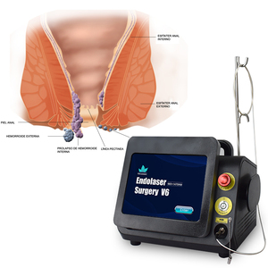 Appareil de traitement au laser pour hémorroïdes et fistules anales, laser diode à faible invasivité, 980 nm + 1470 nm - Product Image 5