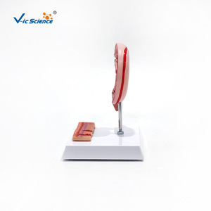 Modèle d'ulcère gastrique, modèle de perforation gastrique, modèle pédagogique de pathologie de l'estomac humain, modèle de coupe transversale gastrique - Product Image 3