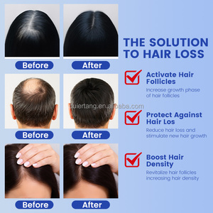 Tratamiento Personalizado Anticaída del Cabello, Aceite para el Crecimiento del Cabello, Aceite Natural de Biotina y Vitamina E para el Crecimiento del Cabello de Marca Privada - Product Image 4