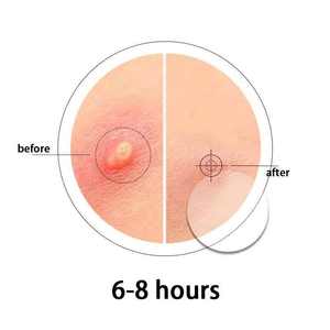 गर्म बिक्री 2026 आर्गेटीना उच्च गुणवत्ता वाले फुटबॉल पैच ट्रॉफी पैटर्न से अनुमोदित मुँहासे पैच - Product Image 6