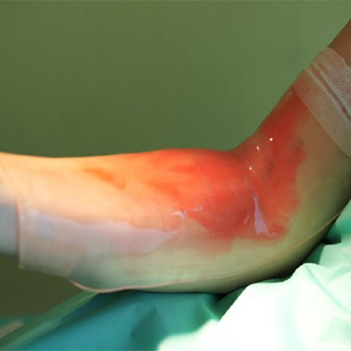 Wide Varieties Hydrogel Burn/Wound Care Surgical Medical Gel Dressing