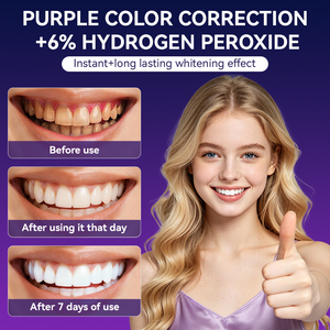 7 트리트먼트 커스텀 6% HP 퍼플 치아 미백 에나멜 안전 장기 보관 가능 건식 용해 치아 미백 스트립 - Product Image 5