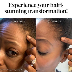 Marque privée <span class=keywords><strong>Shampooing</strong></span> antichute à la biotine <span class=keywords><strong>Shampooing</strong></span> et après-shampoing bio pour la croissance des cheveux - Product Image 3