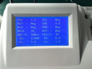 Nhà sản xuất y tế thiết bị phòng thí nghiệm W-200B bán tự động phân tích nước tiểu nhanh chóng kiểm tra 10 hoặc 14 Thông số - Product Image 5